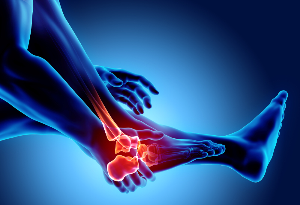 ankle arthritis