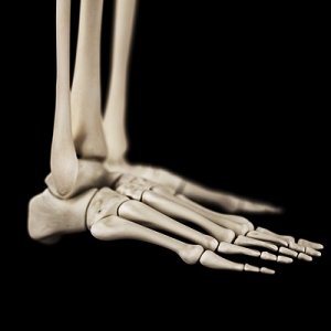 How Footwear Can Lead to Hammertoes